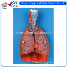 ISO Larynx, Heart and Lung model